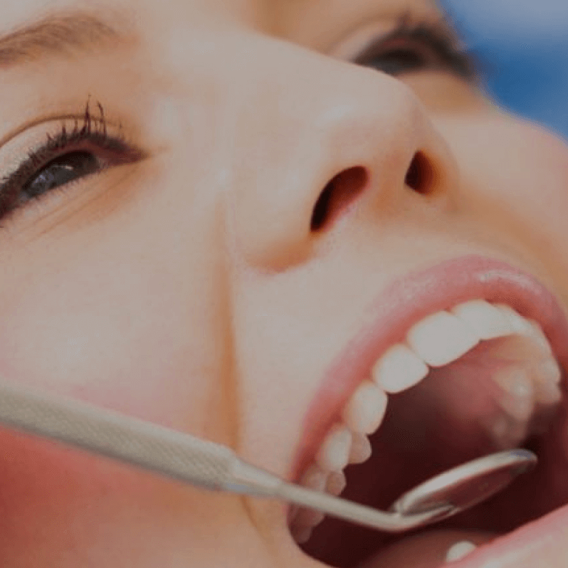 Implantsmile / Kidsmile - Clínica Dentária