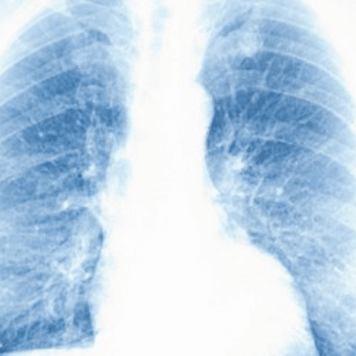 CARPA – Clínica de Alergologia, Respiração e Pneumologia