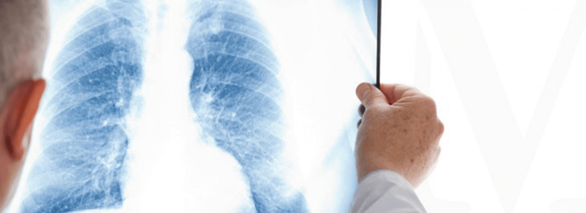 CARPA – Clínica de Alergologia, Respiração e Pneumologia